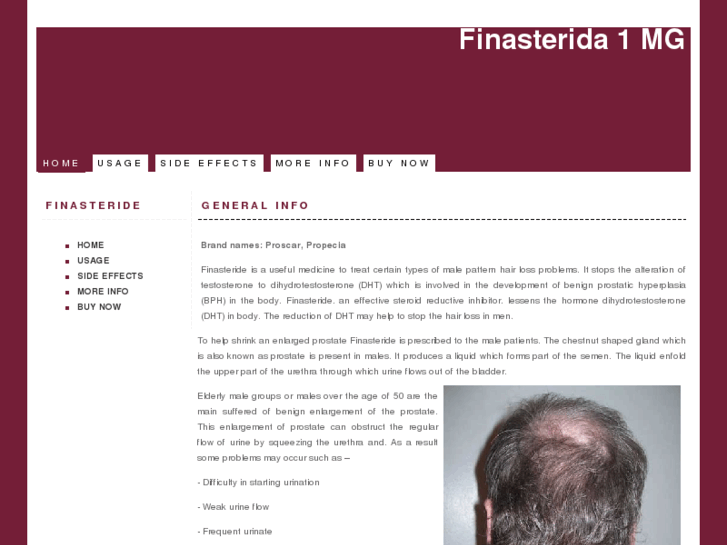 www.finasteride1mg.org