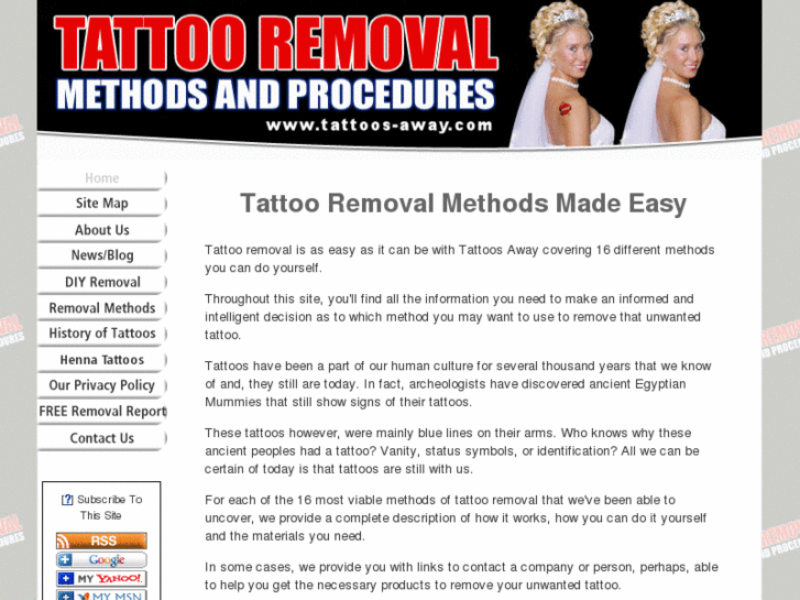 www.tattoos-away.com