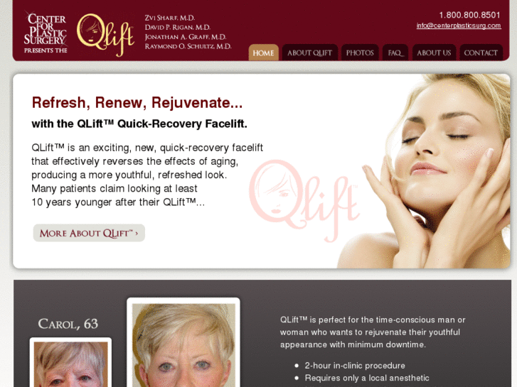 www.qliftfacelift.com