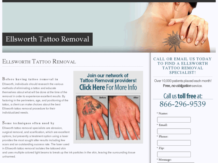 www.ellsworthtattooremoval.com