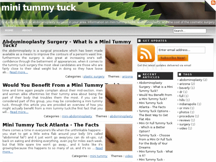 www.minitummytuck.info