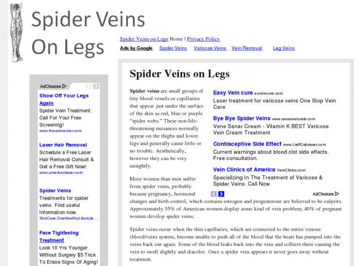 www.spiderveinsonlegs.net