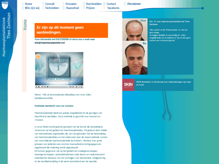 www.haartransplantatie.net