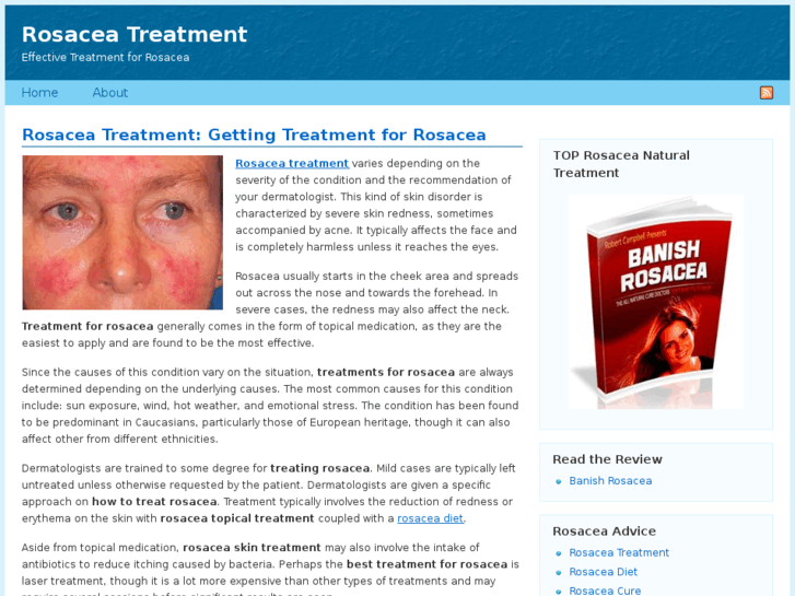 www.rosaceatreatmentnow.com