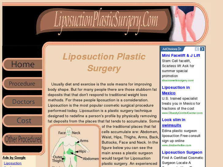 www.liposuctionplasticsurgery.com