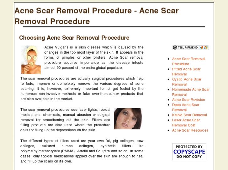 www.simpleacnescarremoval.com