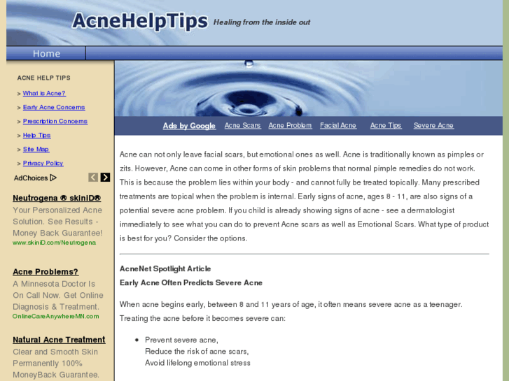 www.acnehelptips.com