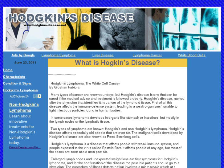 www.hodgkins-disease.net