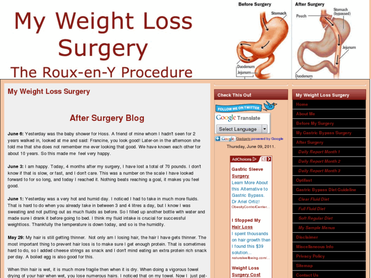 www.myweightloss-surgery.com