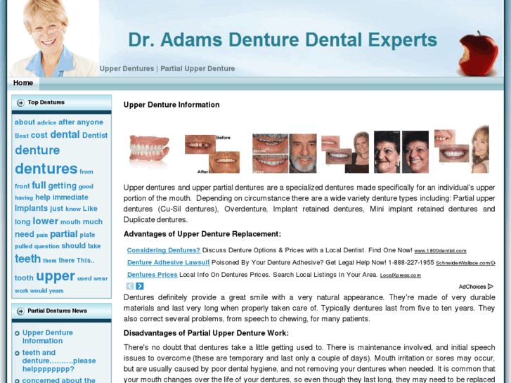 www.upperdentures.net