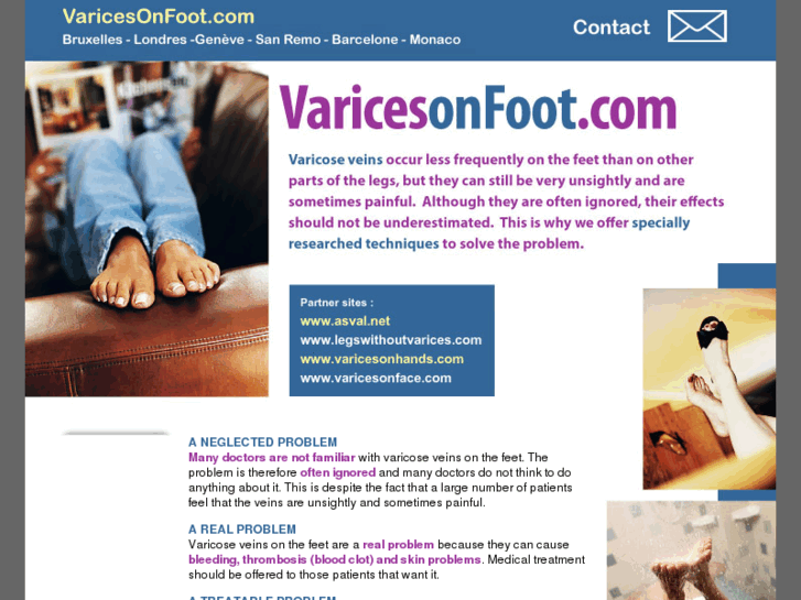 www.varicesonfoot.com