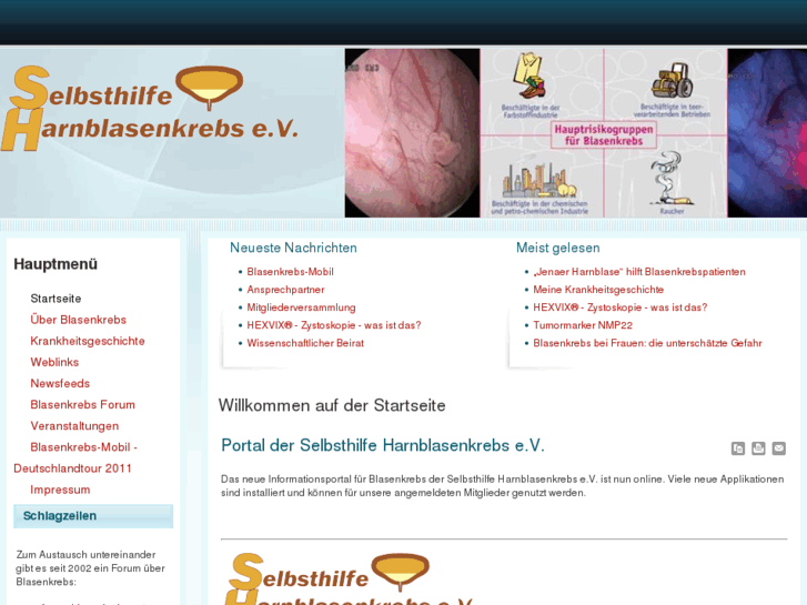 www.selbsthilfe-harnblasenkrebs.de