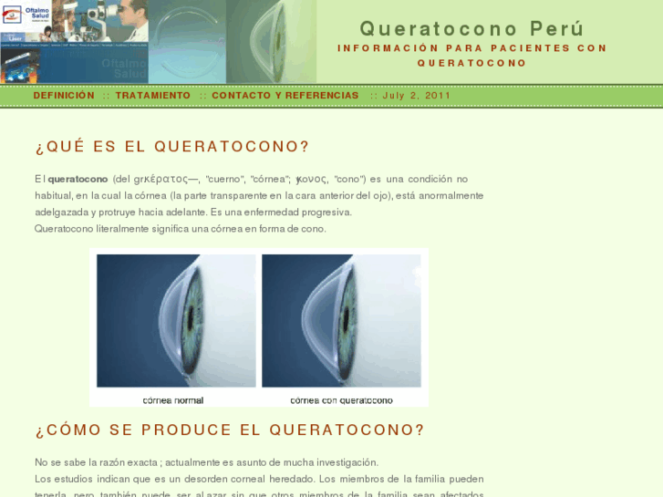 www.queratoconoweb.com