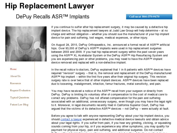 www.hip-replacement-lawyer.com