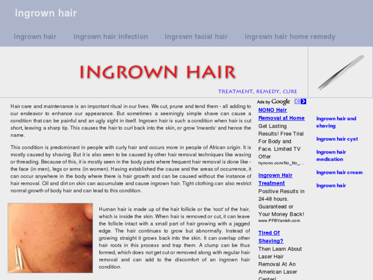 www.ingrown-hair.org