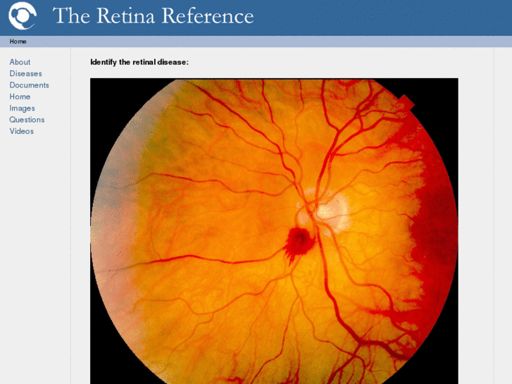 www.retinareference.com