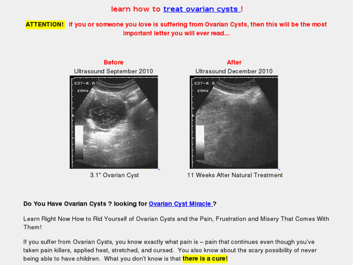 www.treat-ovarian-cysts.com