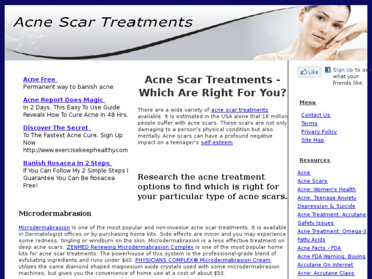 www.acnescar-treatments.com
