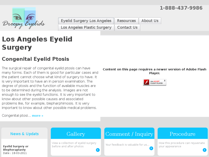 www.eyelidplasticsurgerylosangeles.com