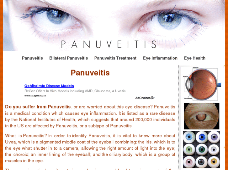 www.panuveitis.com