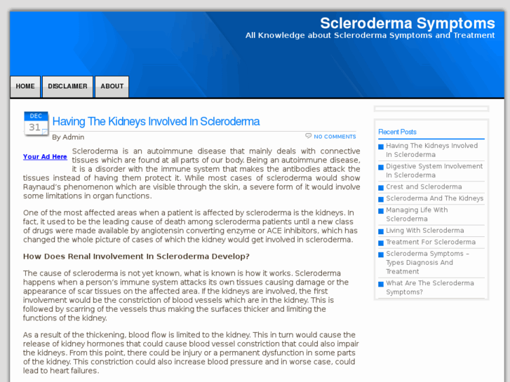www.scleroderma-symptoms.org