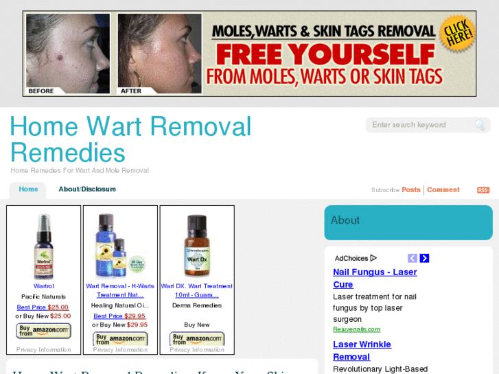 www.homewartremovalremedies.com