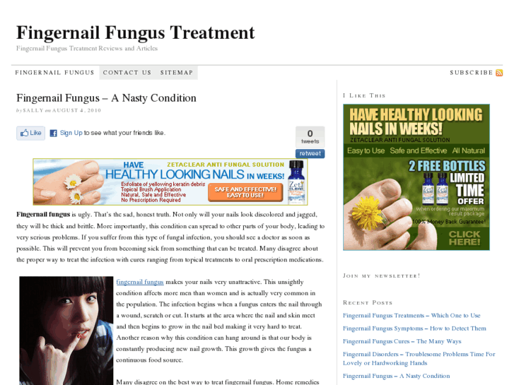 www.fingernailfungus101.org