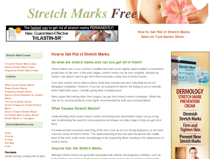 www.stretchmarksfree.com