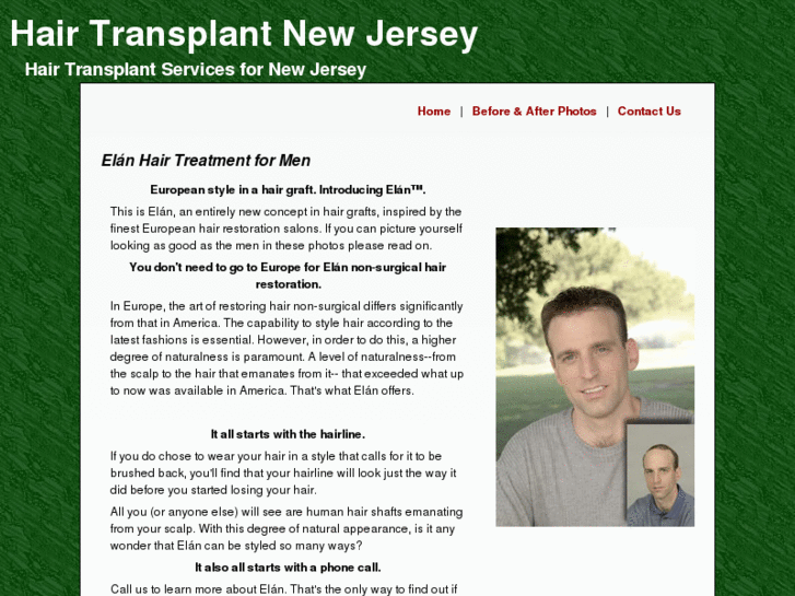 www.hair-transplant-newjersey.com