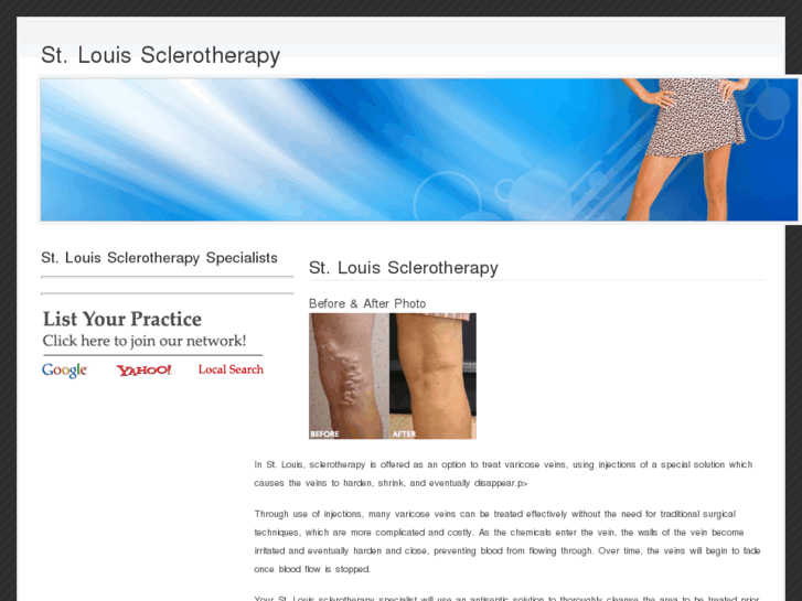 www.stlouissclerotherapy.com