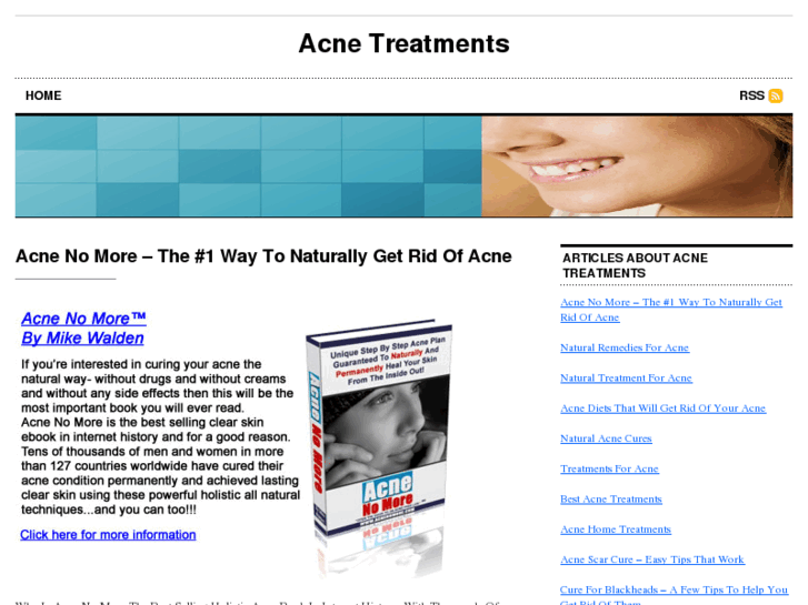 www.acnetreatmentsadvice.com