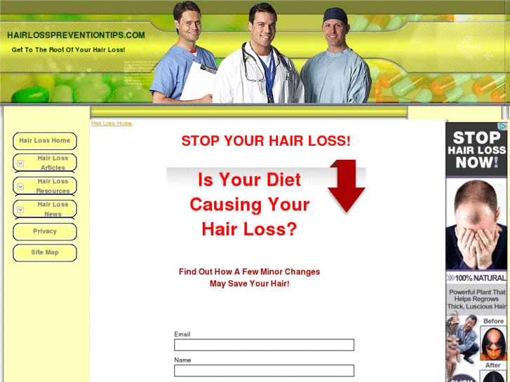 www.hairlosspreventiontips.com