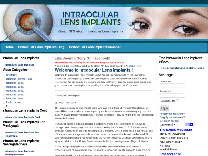 www.intraocularlensimplants.net