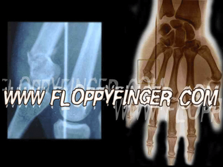 www.floppyfinger.com