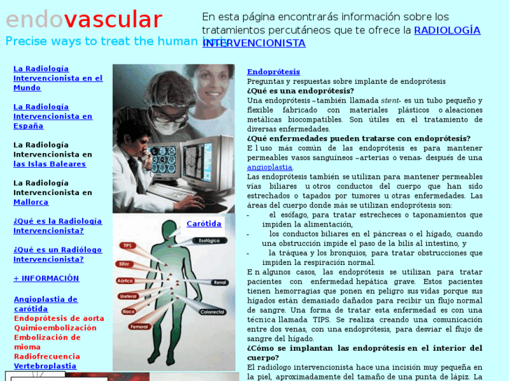 www.carotidaangioplastia.com