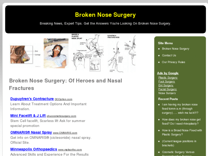 www.brokennosesurgery.net