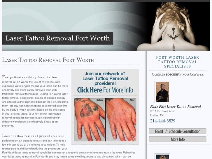 www.lasertattooremovalfortworth.com