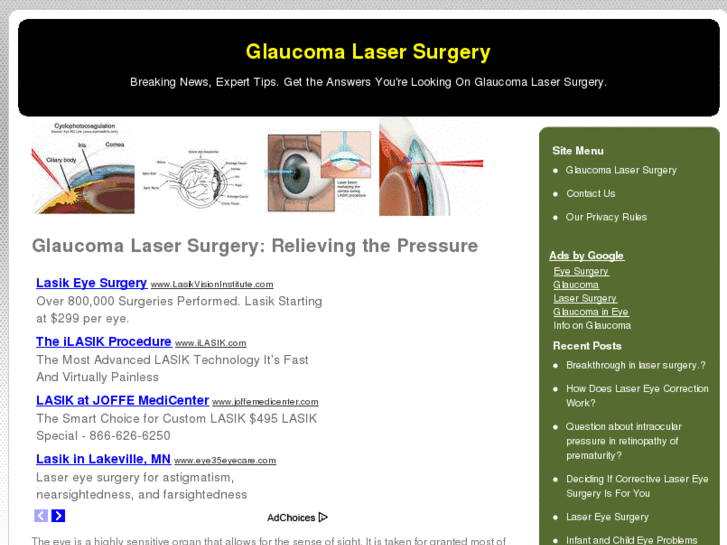 www.glaucomalasersurgery.net