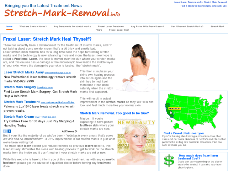 www.stretch-mark-removal.info