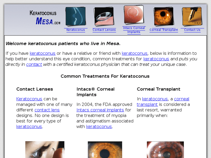 www.keratoconusmesa.com