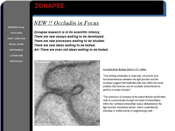 www.zonapse.net