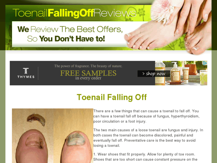 www.toenailfallingoff.com