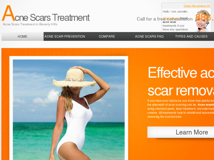 www.acnescars-beverlyhills.com