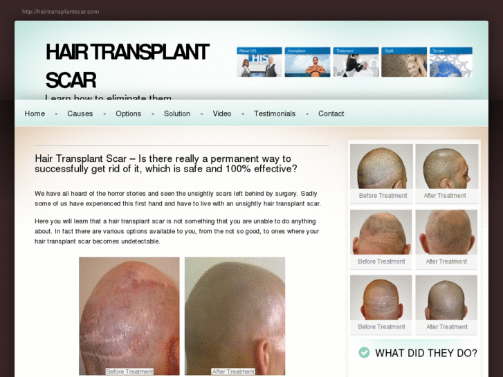 www.hairtransplantscar.com