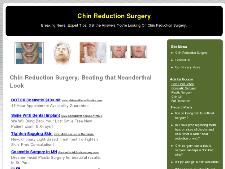 www.chinreductionsurgery.net