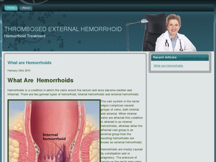 www.thrombosedexternalhemorrhoid.com