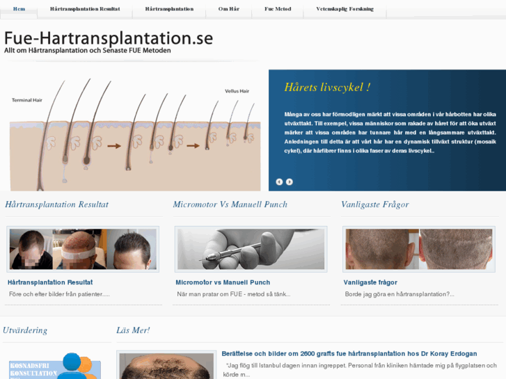 www.fue-hartransplantation.se