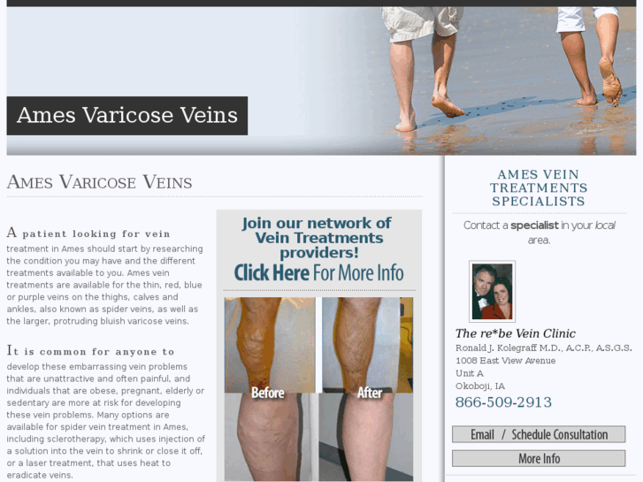 www.amesvaricoseveins.com