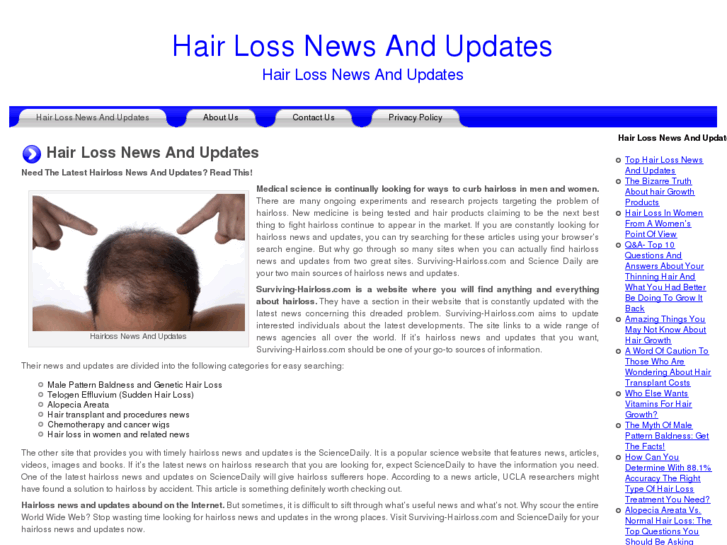 www.hairlossnewsandupdates.com