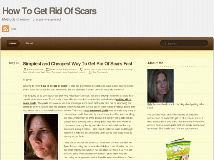 www.howtogetridofscars.info